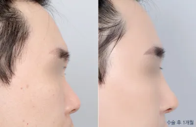 Before & After