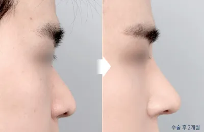 Before & After