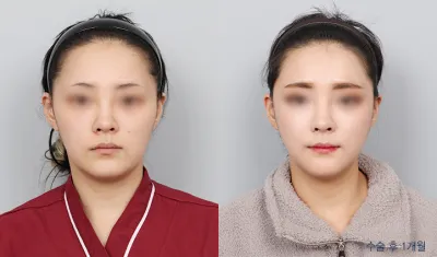 Before & After