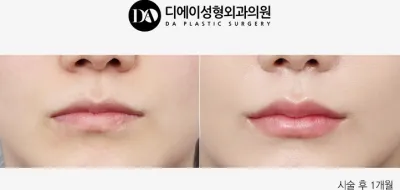 Before & After