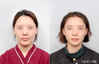 Before & After