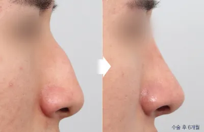 Before & After