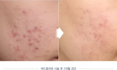 Before & After