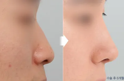 Before & After