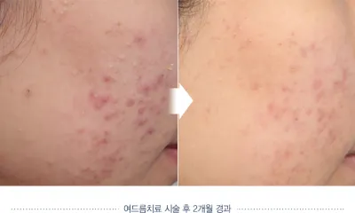 Before & After