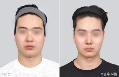 Before & After