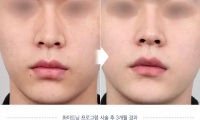 Before & After