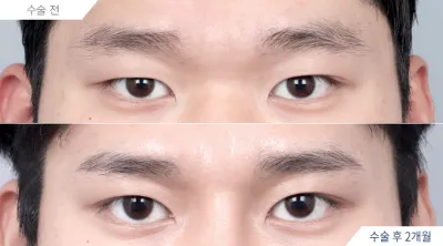 Before & After