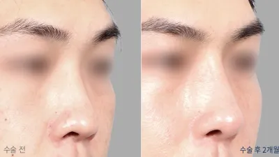 Before & After