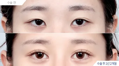 Before & After