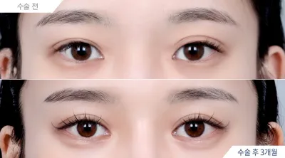 Before & After