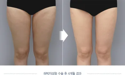 Before & After