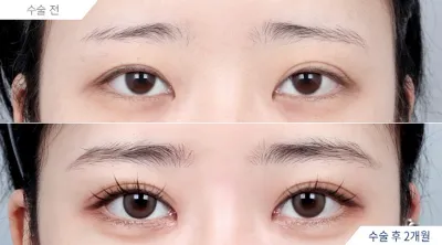 Before & After