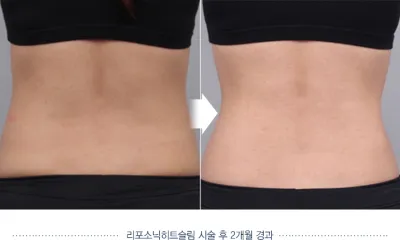 Before & After