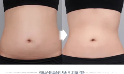 Before & After
