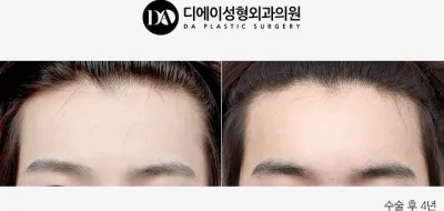 Before & After