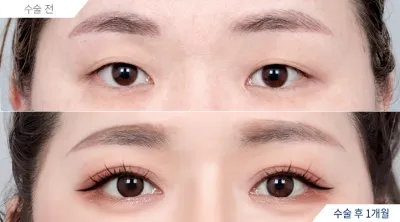 Before & After