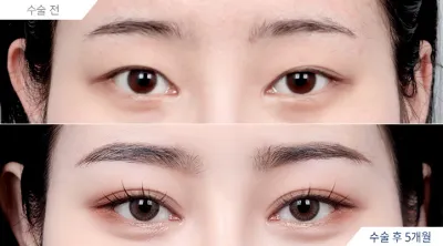 Before & After