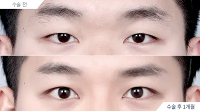 Before & After