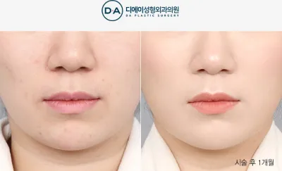 Before & After