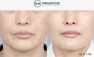 Before & After