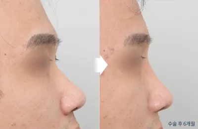 Before & After