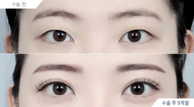 Before & After