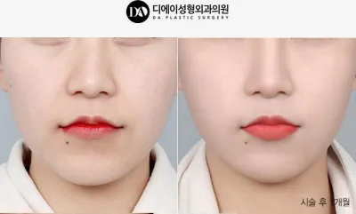 Before & After