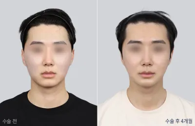 Before & After