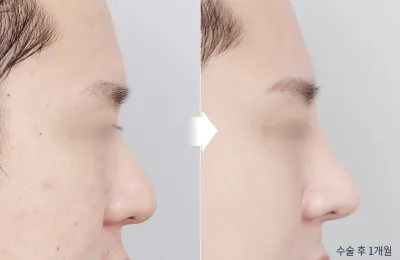 Before & After