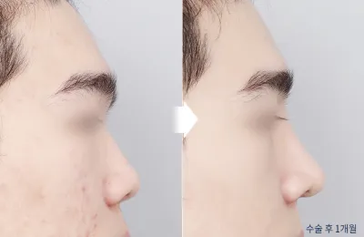 Before & After