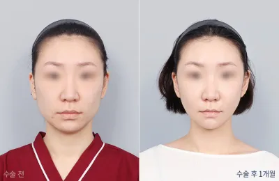 Before & After