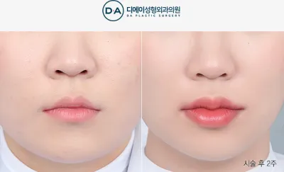 Before & After