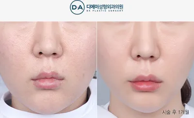 Before & After