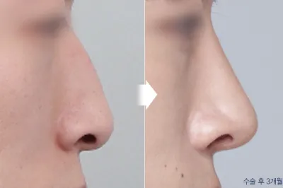 Before & After