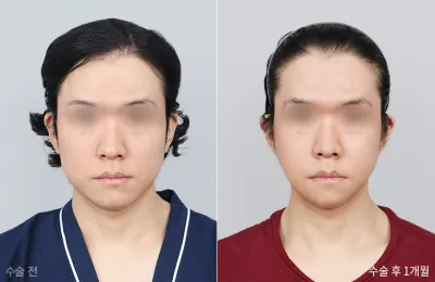 Before & After