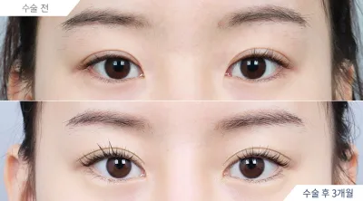 Before & After