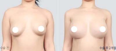 Before & After