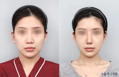Before & After