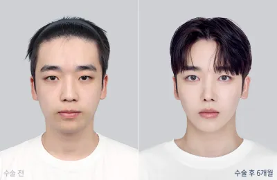Before & After