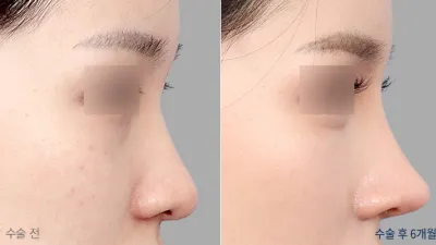 Before & After