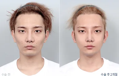 Before & After
