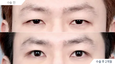 Before & After