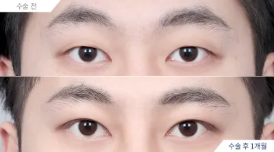 Before & After