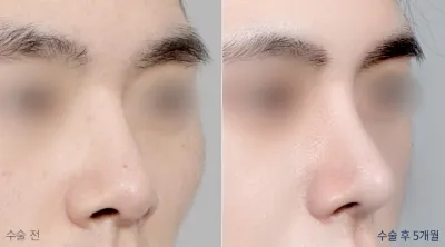 Before & After