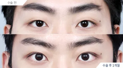 Before & After