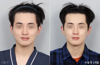 Before & After