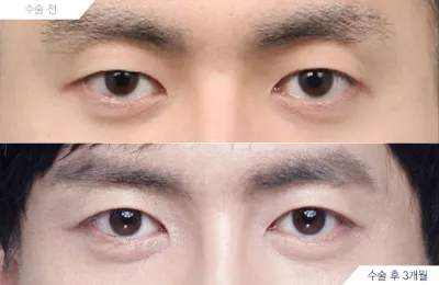 Before & After