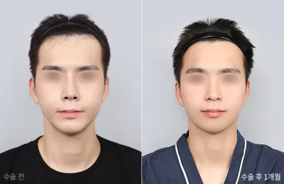 Before & After