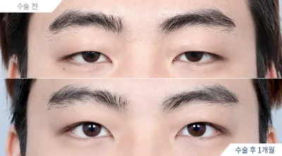 Before & After